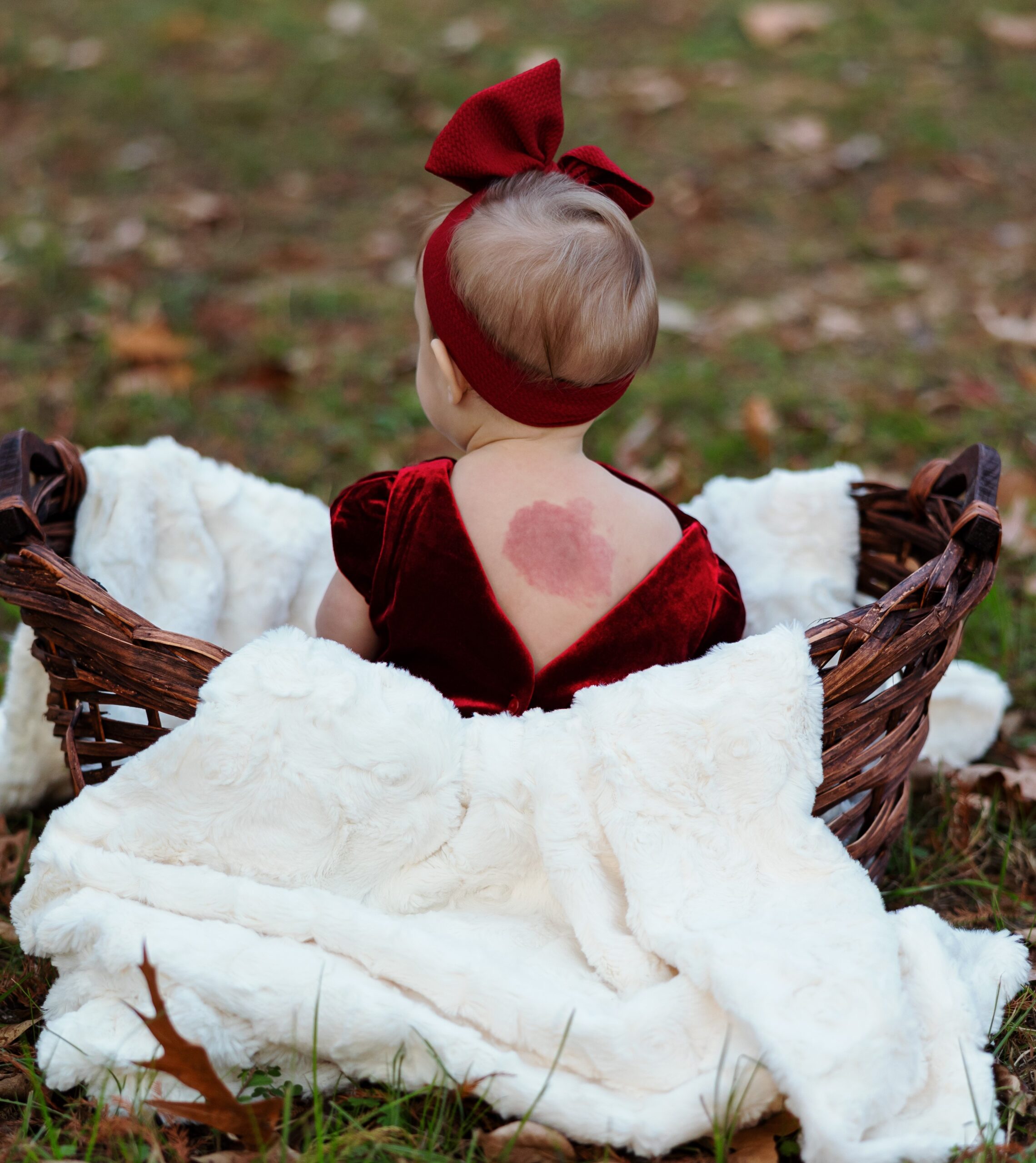 Birthmark Blessings